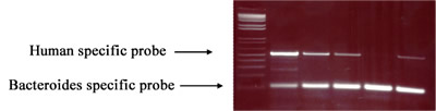 Polymerase chain reaction analysis showing the Human specific and Bacteroides specific DNA primers. 
